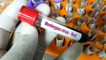 Se han detectado 19 casos de viruela del mono en BC